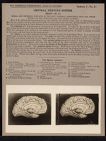 Central Nervous System. Brain - no. 21